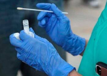 COVID-19: SE REALIZÓ UN OPERATIVO DE TESTEOS MASIVO