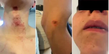 VEDIA: PEÓN DE CAMPO TORTURADO Y GOLPEADO POR SUS PATRONES VEDIA: PEÓN DE CAMPO TORTURADO Y GOLPEADO POR SUS PATRONES