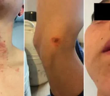 VEDIA: PEÓN DE CAMPO TORTURADO Y GOLPEADO POR SUS PATRONES