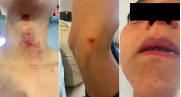 VEDIA: PEÓN DE CAMPO TORTURADO Y GOLPEADO POR SUS PATRONES